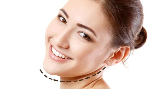 Chin Augmentation Dr. Ranjit Bhosle - Best Plastic Surgeon | Gynecomastia | Cyst Removal | Lipoma | Breast Surgery | Liposuction Expert.Dr. Ranjit Bhosale - Best Plastic Surgeon | Gynecomastia | Liposuction Expert| Cyst Removal Lipoma | Hair, Transplant. Ghatkopar West, , Borivali East, Mumbai, Maharashtra,Maroshi Rd Andheri.